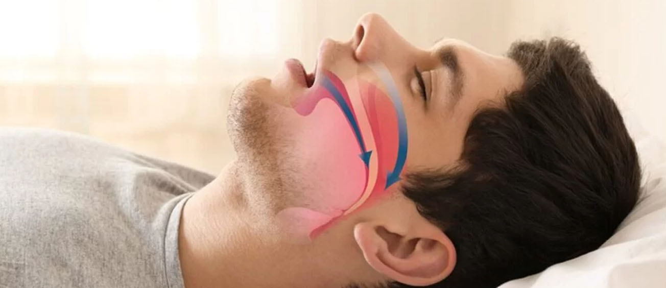 Mouth Breathing… Why breathing through your nose is so important! Mouth Breathing… Why breathing through your nose is so important!