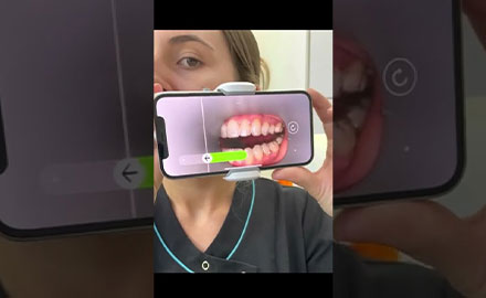 How to Use Your Dental Monitoring Scan Box 