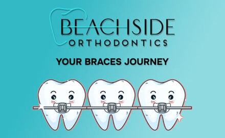 Getting to know your braces